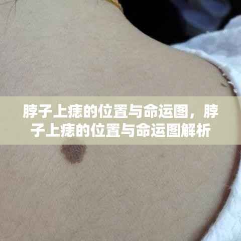 脖子上痣的位置与命运解析图,揭示痣相与命运关联的秘密